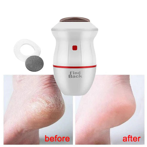 DermaPies · Removedor de Callos